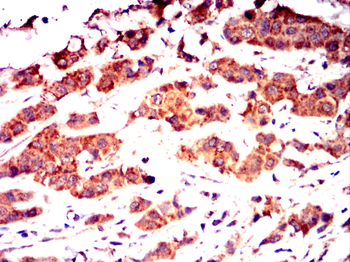 GSTM1 Antibody