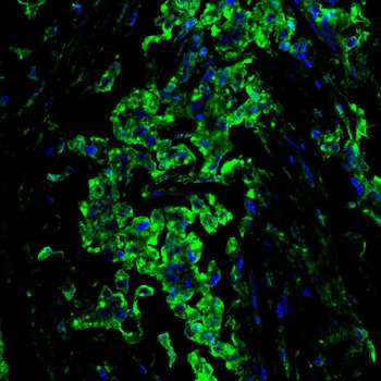 GSTM1 Antibody