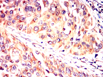 GSTM1 Antibody
