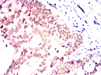 PKN2 Antibody