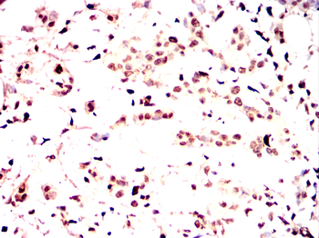 PKN2 Antibody