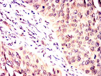 PKN2 Antibody