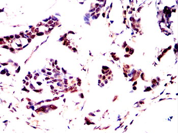 FOXP1 Antibody