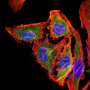 RPL18A Antibody