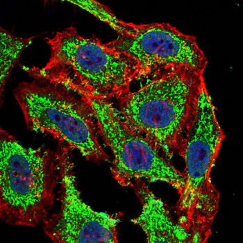CD33 Rabbit Polyclonal Antibody