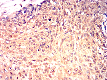 TUBB2A Antibody