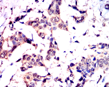 CDKN1A Antibody