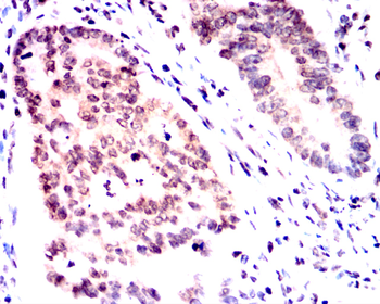 PPARA Antibody