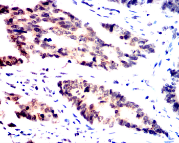 IRS1 Antibody