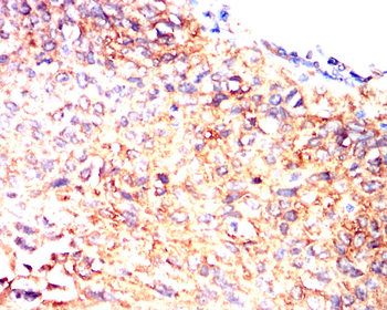 SREBF1 Antibody