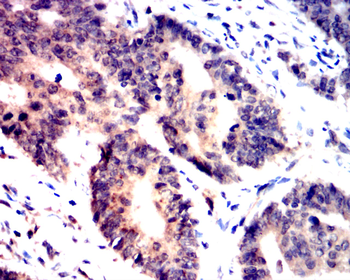 MAP2K1 Antibody