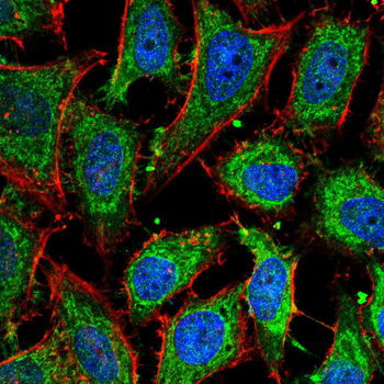 GSDMD Antibody