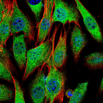 BAD Antibody
