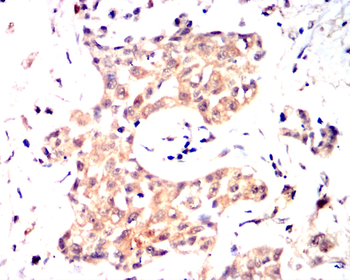 BAD Antibody