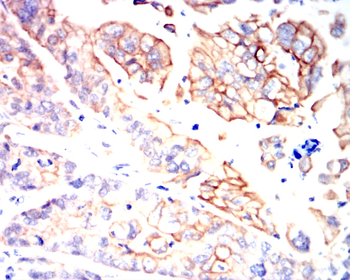 KRT19 Antibody