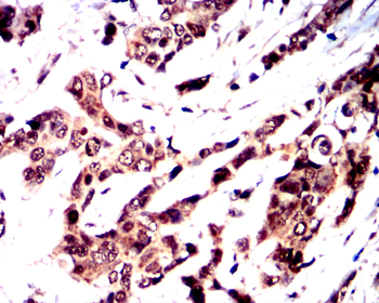 RELA Antibody