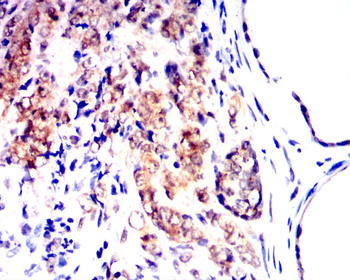 RELA Antibody