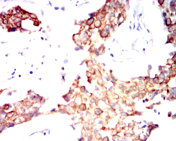 KRT19 Antibody