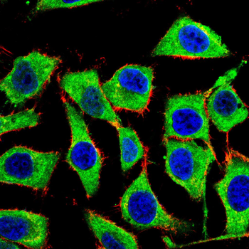 FAS Antibody