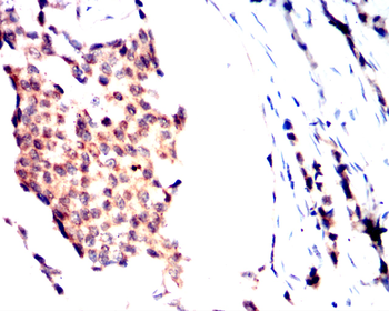 FAS Antibody
