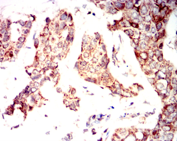 S100A8 Antibody