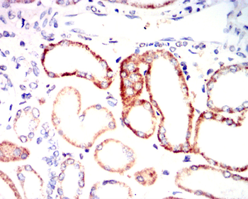 S100A8 Antibody