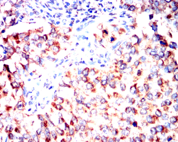FGFR3 Antibody