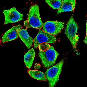 IL5 Rabbit Polyclonal Antibody