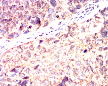 IL5 Rabbit Polyclonal Antibody