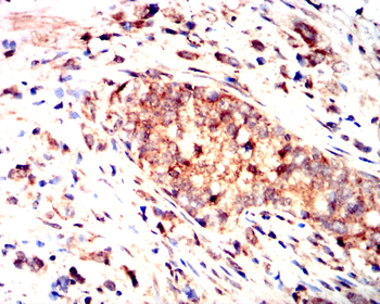 IL5 Rabbit Polyclonal Antibody