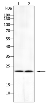 IL5 Rabbit Polyclonal Antibody