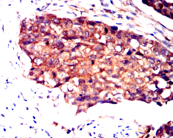 PRKCA Antibody