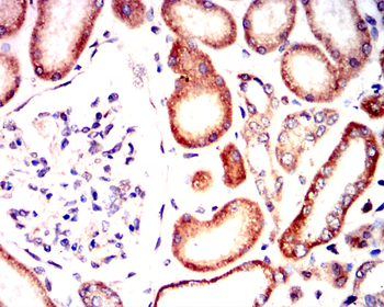 PRKCD Antibody