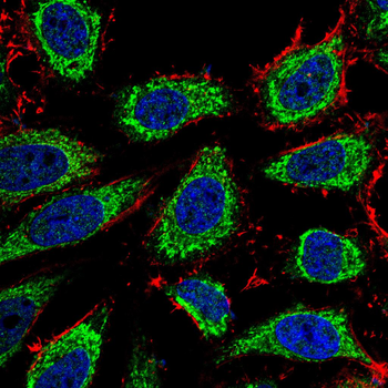 HLA-A Antibody