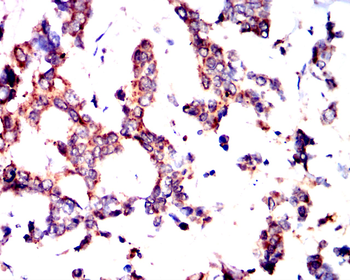 HLA-A Antibody