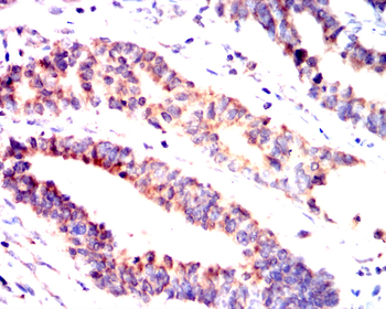 HLA-A Antibody