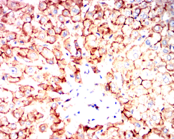 CTNNB1 Antibody