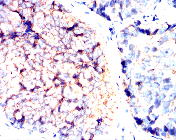 CTNNB1 Antibody