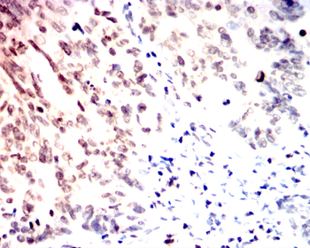 S100A1 Antibody