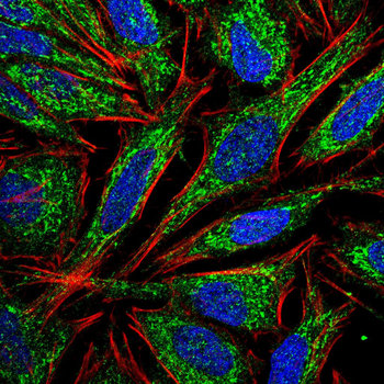 EPCAM Rabbit Polyclonal Antibody