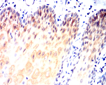 BMPR2 Antibody