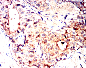 MMP13 Rabbit Polyclonal Antibody