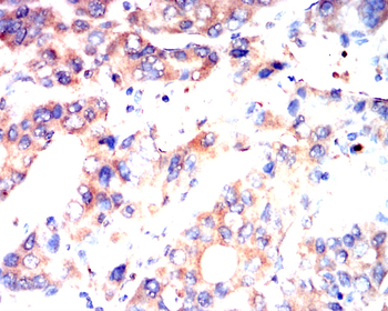 MMP13 Rabbit Polyclonal Antibody