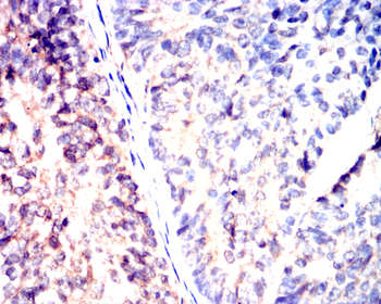 MMP13 Rabbit Polyclonal Antibody