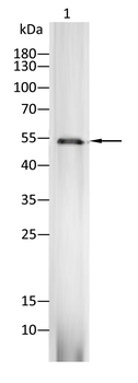 MMP13 Rabbit Polyclonal Antibody