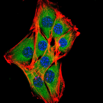 PGR Antibody