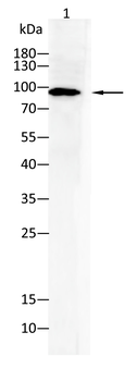 PGR Antibody