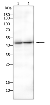 DCX Antibody