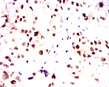 CDKN2B Rabbit Polyclonal Antibody