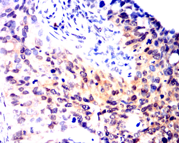 CDKN2B Rabbit Polyclonal Antibody